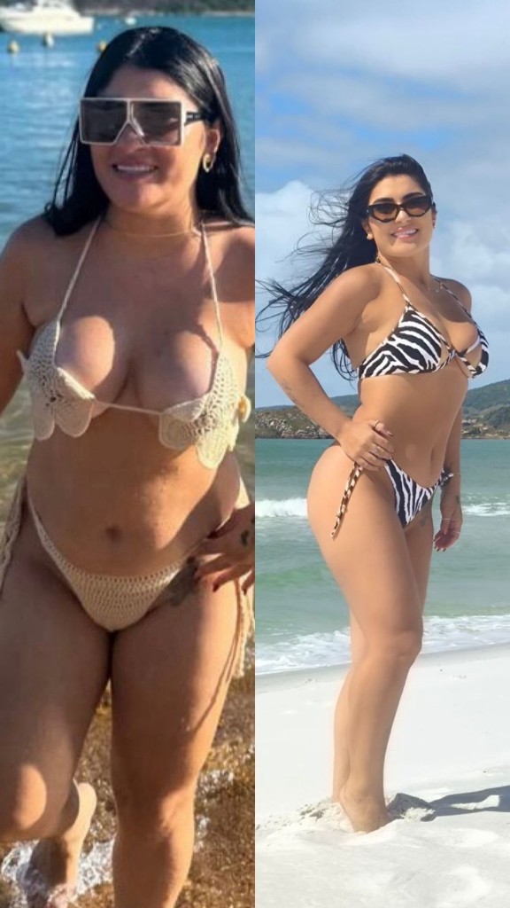Mayara — antes e depois do programa Chave da Mente Magra